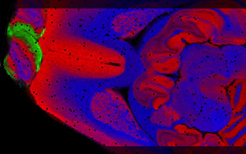 Rat brain showing distribution of three specific lipids