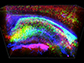 NSF-funded scientists developed a new imaging technology to see into the brain.