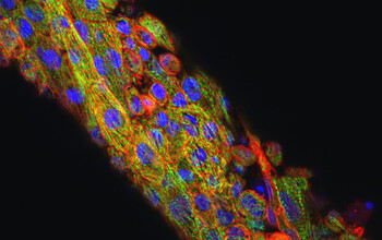 Microtissues stained to distinguish the cell nuclei (blue), sarcomeric alpha-actinic (red) and Myosin Binding Protein C (green)