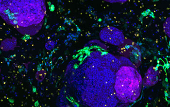 Tiny pancreatic organoids grown using synthetic gel