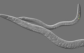 C. elegans adult hermaphrodite (lower) and male (upper), with two fluorescing neurons