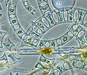 seawater viewed under microscope