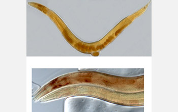 A micrograph of a free-living roundworm (<em>C. elegans</em>)