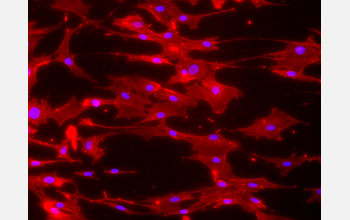 Fluorescent image of mouse bone cells cultured on nanofibers with cells stained red with blue nuclei