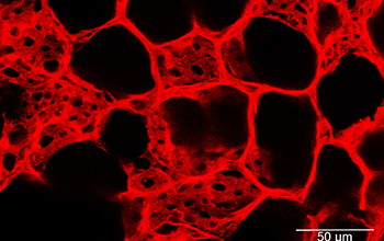 Confocal imaging reveals the dense network of capillary blood vessels in the lungs