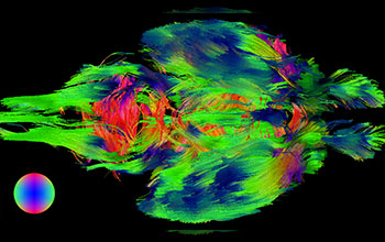 Streamlines in mouse brain indicating direction of white matter tracts