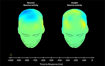image showing insight-related brain activity