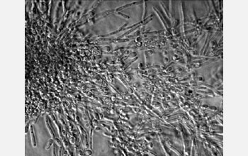 The pathogenic fungus <em>Candida albicans</em>