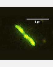 Microscopic images of bacteria