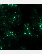 Photomicrograph of fluorescent microbes.