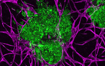 3D bioprinted breast cancer tumors (green)