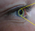 Conceptual schematic of an intelligent contact lens for health monitoring.