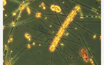 Diatom algae <em>Chaetoceros sp.</em>