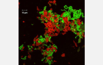 Photomicrograph showing in red and green two co-symbiotic bacteria within a  cicada.