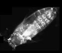 Images of copepod Acartia tonsa carcasses at different stages of decomposition.