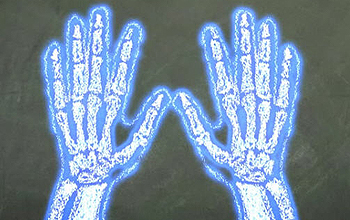 Illustration of an x-ray of a pair of hands