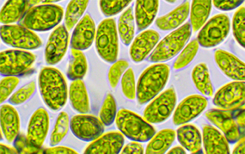 Acutodesmus deserticola, a desert-derived green algae