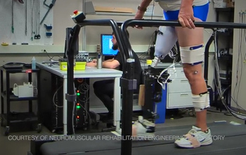 on with a prosthetic leg on a tread mill