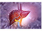 Scientists are developing a new way to detect fatty liver disease.