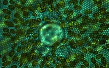 Light photomicrograph of a centeric diatom showing green chloroplasts and silica pore structure.