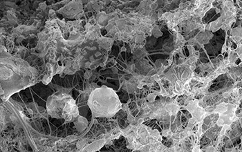 Cross-section view of electrospun tubes