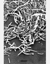 SEM of <em>Heliobacterium chlorum</em> cells, a slow-moving bacterium