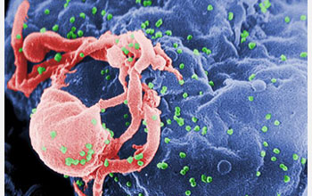 the human immunodeficiency virus (HIV), taken with a scanning electron microscope.