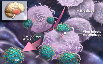 Illustration depicting white blood cells swarming to attack HIV in the brain