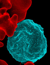 Colorized electron micrograph of red blood cell infected with malaria parasites, blue.