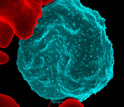 Colorized electron micrograph of red blood cell infected with malaria parasites, blue.