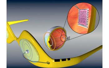 Artificial retina device