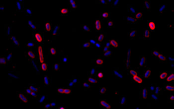 Microscopic image showing newly discovered bacterial strain; cell walls are red, DNA is blue.