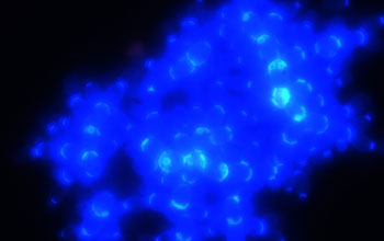 multi-cellular yeast showing hundreds of cells.