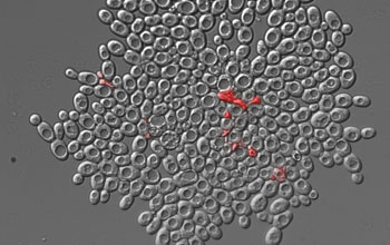 aberrant shapes of multi-cellular yeast's dead cells that are stained red.