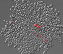 aberrant shapes of multi-cellular yeast's dead cells that are stained red.