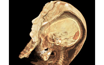 High-resolution CT scan of an Egyptian child mummy