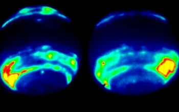 Two images illustrating the changes in the high-altitude cloud structure on Neptune