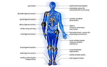 Sensors have a range of potential uses in medicine.