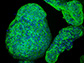 Researchers have developed a synthetic gel that can be used to grow pancreatic organoids, seen here.