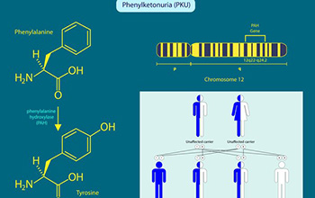 A new discovery offers hope of a treatment for phenylketonuria.