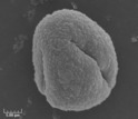 enlarged image of single oak pollen grain,