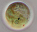 Image with an arrow pointing to the photosynthetic-boosting pyrenoid in a cell.