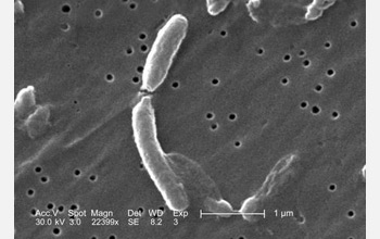 Scanning electron micrograph depictintg two Vibrio cholerae bacteria about to separate.