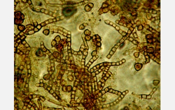 Microscopic photo of metal-oxidizing bacteria found in biofilm samples taken from gold mine bottom