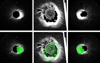 coronal mass ejection