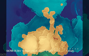 Scanning electron microscope image of soil dust with adhering soot