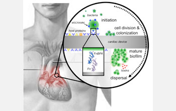 Illustration showing stages of Staphylococcus aureus biofilm formation on prosthetic heart valves.