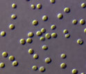 Micrograph of a small phytoplankton believed to be similar to the symbiont.