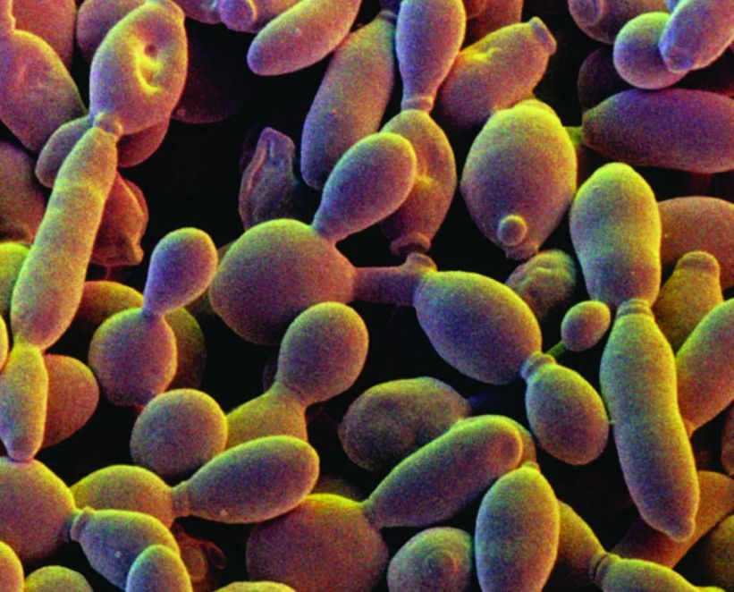 Multimedia Gallery - Yeast cells of the species Saccharomyces ...