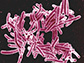 scanning electron micrograph of <em>Mycobacterium tuberculosis</em> bacteria
